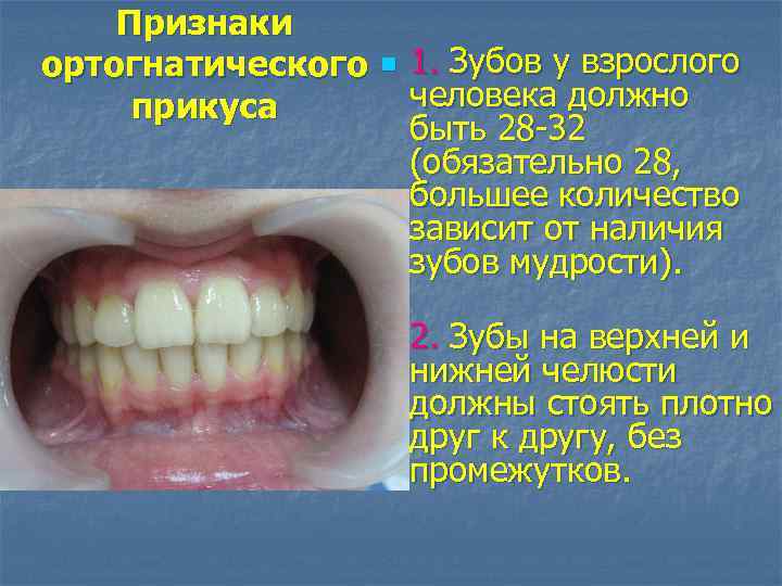 Признаки ортогнатического прикуса n n 1. Зубов у взрослого человека должно быть 28 -32