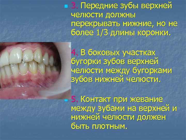 n n n 3. Передние зубы верхней челюсти должны перекрывать нижние, но не более
