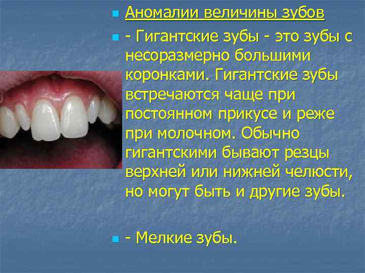 n n n Аномалии величины зубов - Гигантские зубы - это зубы с несоразмерно