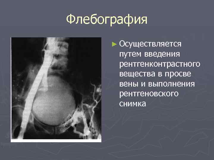 Хроническая венозная недостаточность нижних конечностей фото