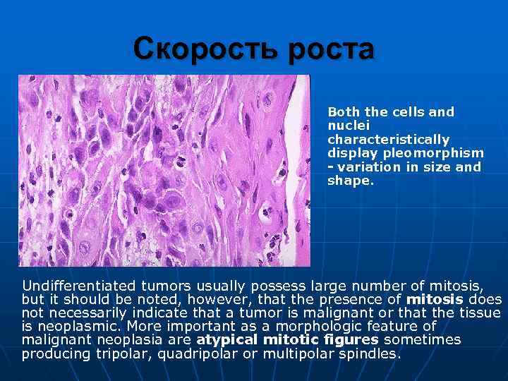 Скорость роста Both the cells and nuclei characteristically display pleomorphism - variation in size
