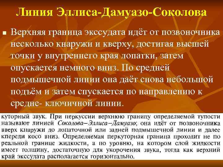 Линия Эллиса-Дамуазо-Соколова n Верхняя граница экссудата идёт от позвоночника несколько кнаружи и кверху, достигая