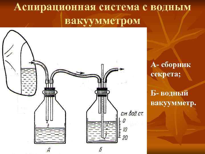 Аспирационная система с водным вакуумметром А- сборник секрета; Б- водный вакуумметр. 