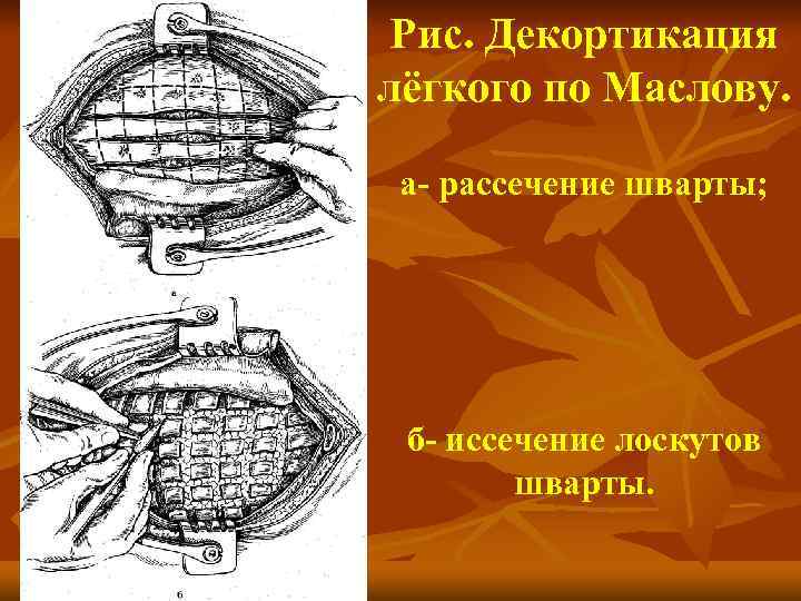 Факультетская хирургия в схемах и таблицах