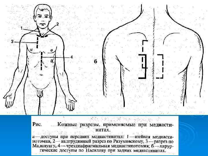 Заболевания пищевода факультетская хирургия презентация