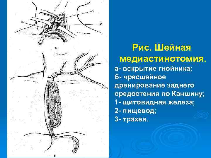 Заболевания пищевода факультетская хирургия презентация