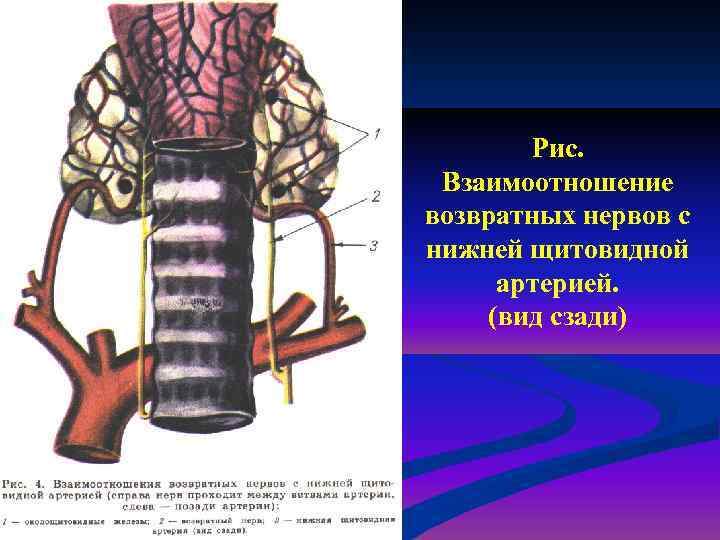 Рис. Взаимоотношение возвратных нервов с нижней щитовидной артерией. (вид сзади) 