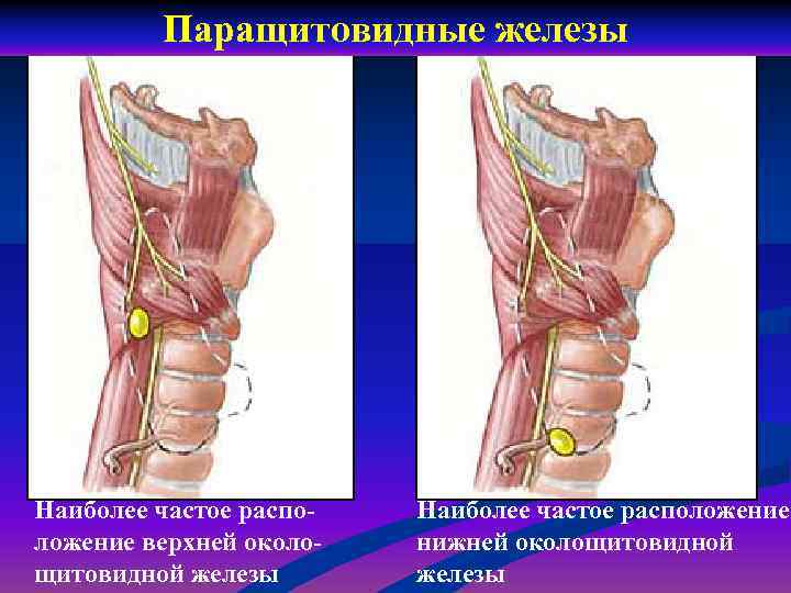Паращитовидные железы Наиболее частое расположение верхней околощитовидной железы Наиболее частое расположение нижней околощитовидной железы