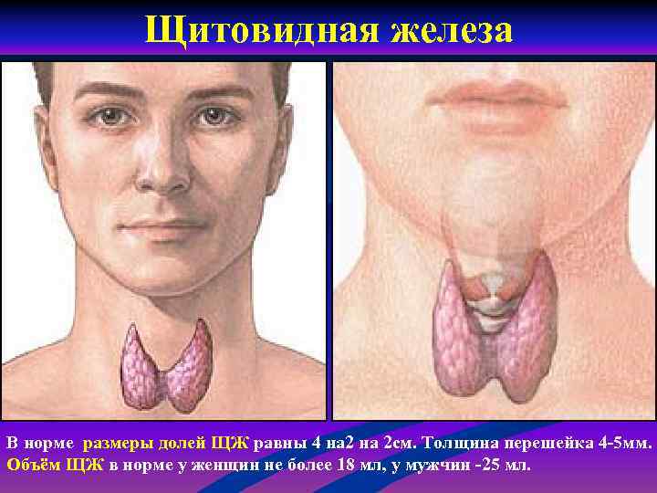 Щитовидная железа В норме размеры долей ЩЖ равны 4 на 2 см. Толщина перешейка