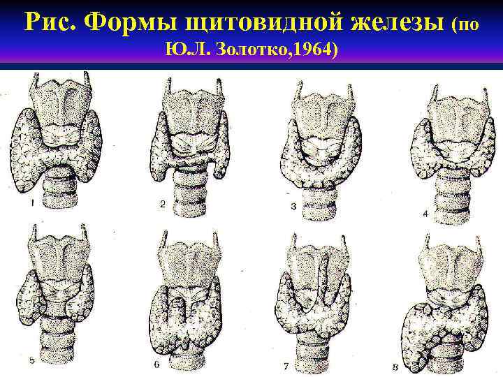 Заболевания щитовидной железы факультетская хирургия презентация