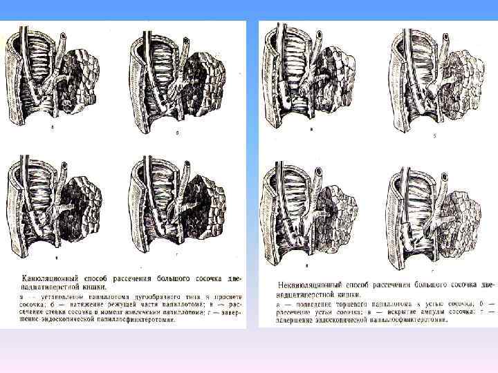 Курс факультетской хирургии в рисунках таблицах и схемах