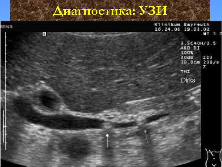 Диагностика: УЗИ 