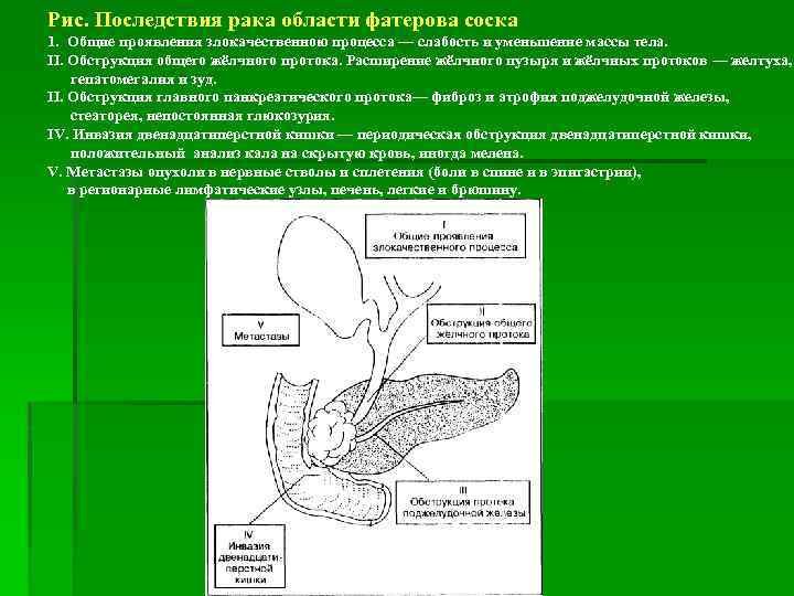 Рис. Последствия рака области фатерова соска 1. Общие проявления злокачественною процесса — слабость и