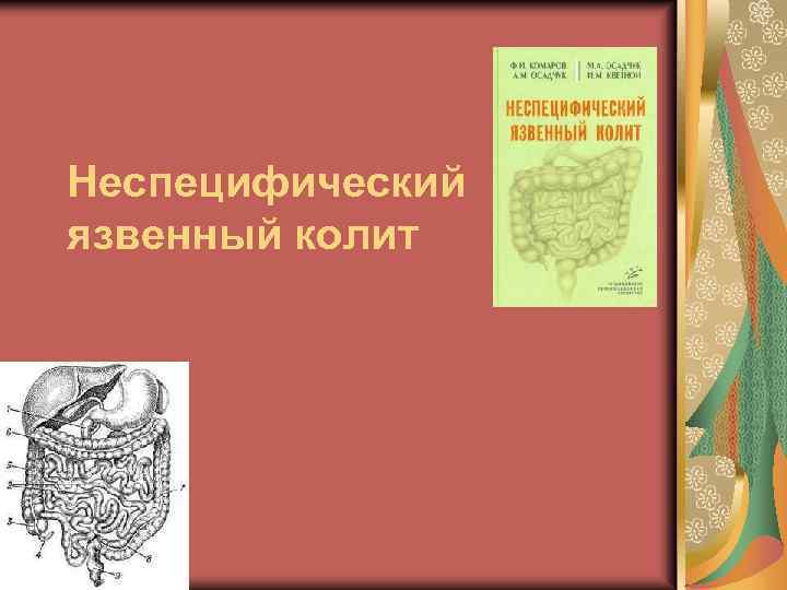 Неспецифический язвенный колит 