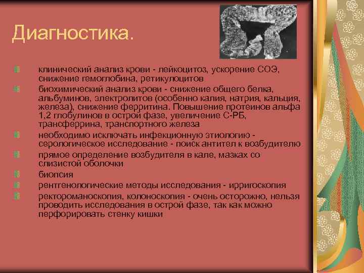 Диагностика. клинический анализ крови - лейкоцитоз, ускорение СОЭ, снижение гемоглобина, ретикулоцитов биохимический анализ крови