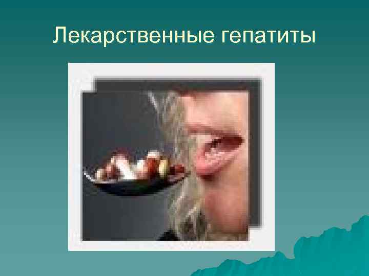 Лекарственные гепатиты 