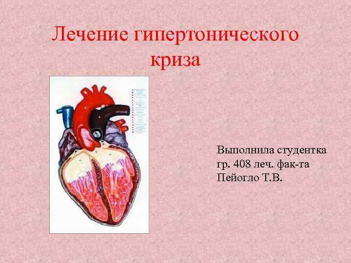 Лечение гипертонического криза Выполнила студентка гр. 408 леч. фак-та Пейогло Т. В. 