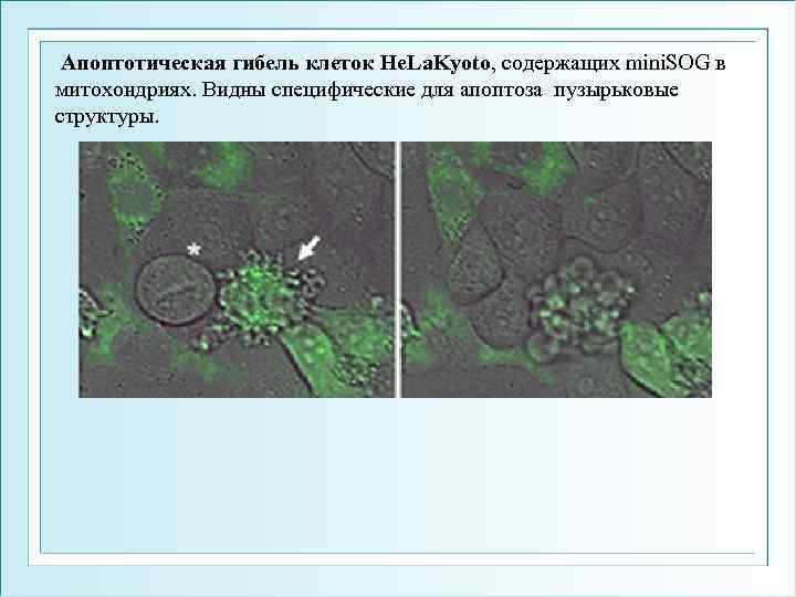  Апоптотическая гибель клеток He. La. Kyoto, содержащих mini. SOG в митохондриях. Видны специфические