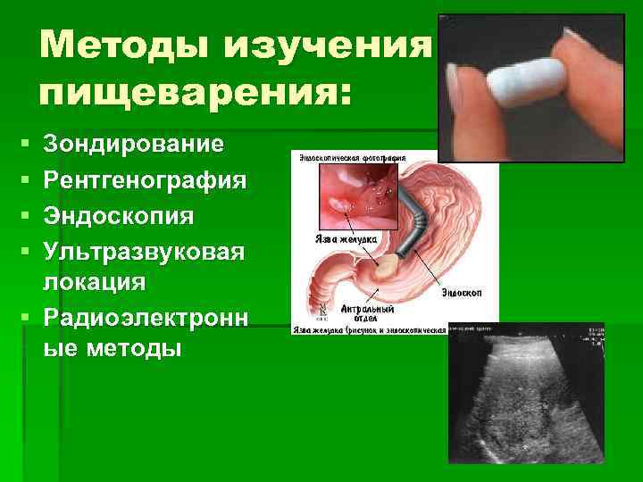 Методы изучения пищеварения: § § Зондирование Рентгенография Эндоскопия Ультразвуковая локация § Радиоэлектронн ые методы