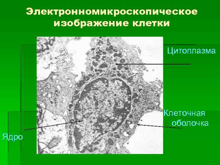 Электронномикроскопическое изображение клетки Цитоплазма Клеточная оболочка Ядро 