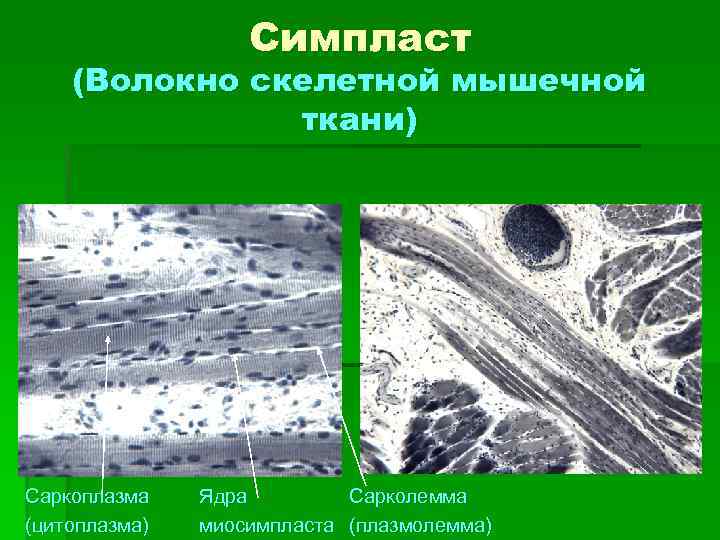 Симпласт (Волокно скелетной мышечной ткани) Саркоплазма (цитоплазма) Ядра Сарколемма миосимпласта (плазмолемма) 