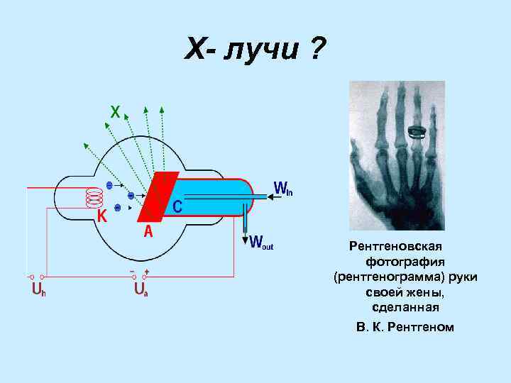Х- лучи ? Рентгеновская фотография (рентгенограмма) руки своей жены, сделанная В. К. Рентгеном 