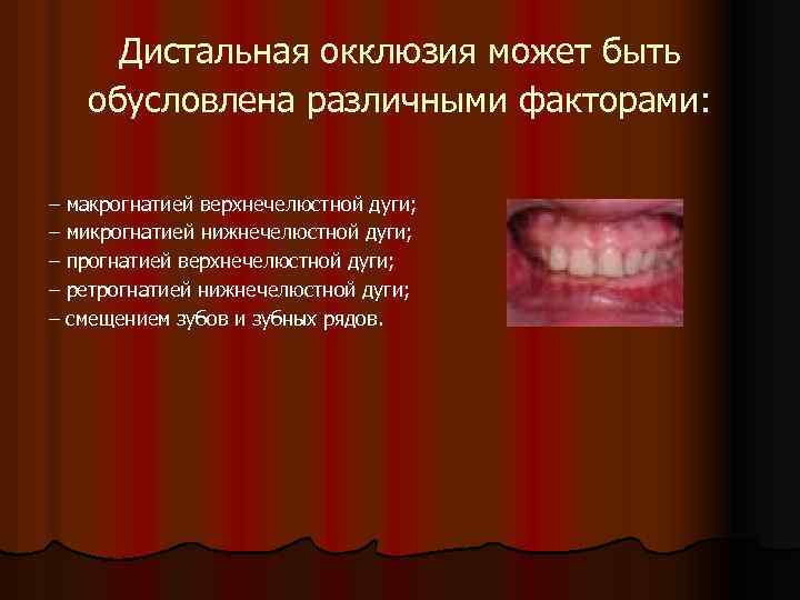 Дистальная окклюзия может быть обусловлена различными факторами: – макрогнатией верхнечелюстной дуги; – микрогнатией нижнечелюстной