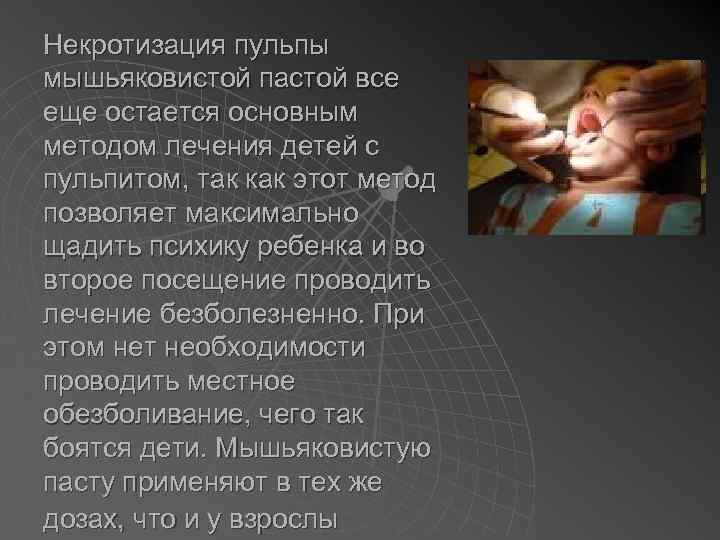 Некротизация пульпы мышьяковистой пастой все еще остается основным методом лечения детей с пульпитом, так