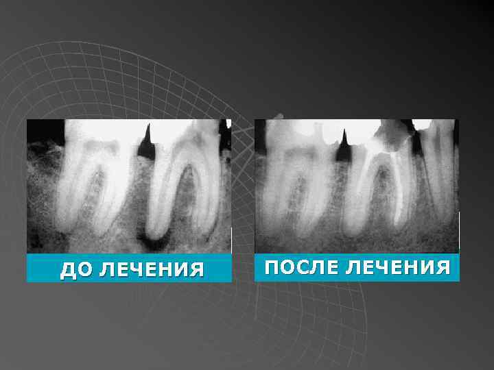 ДО ЛЕЧЕНИЯ ПОСЛЕ ЛЕЧЕНИЯ 