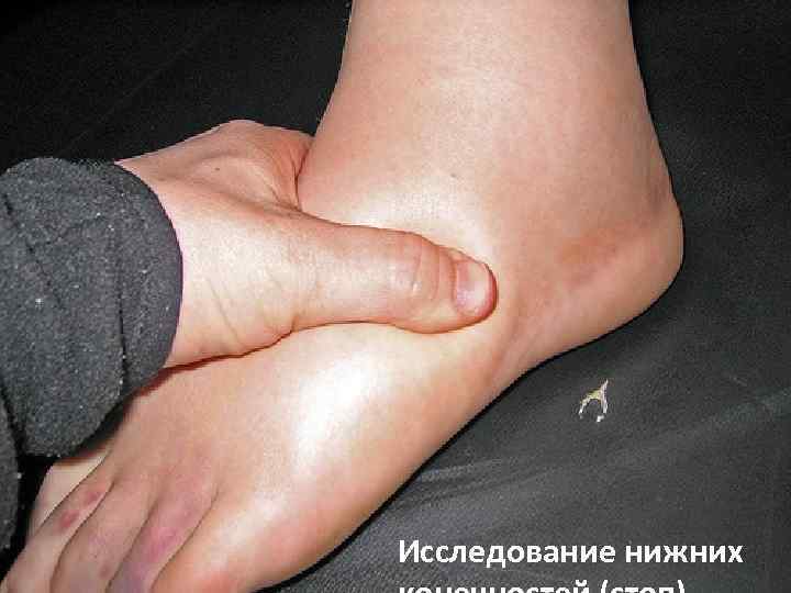 Исследование нижних 