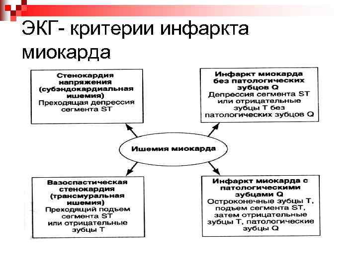 ЭКГ- критерии инфаркта миокарда 