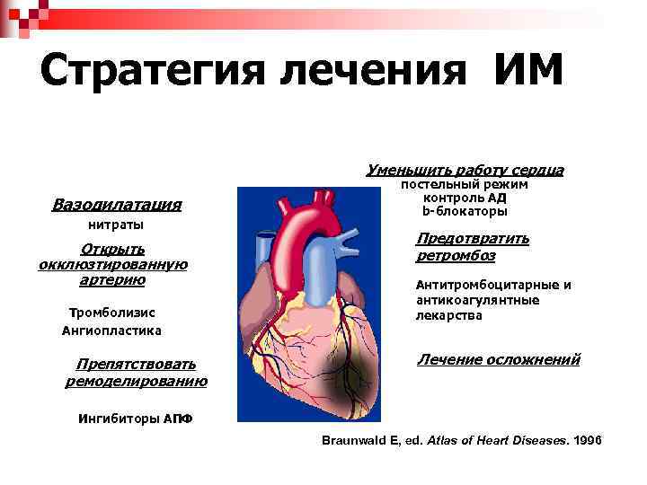 Стратегия лечения ИМ Уменьшить работу сердца Вазодилатация нитраты Открыть окклюзтированную артерию Тромболизис Ангиопластика Препятствовать