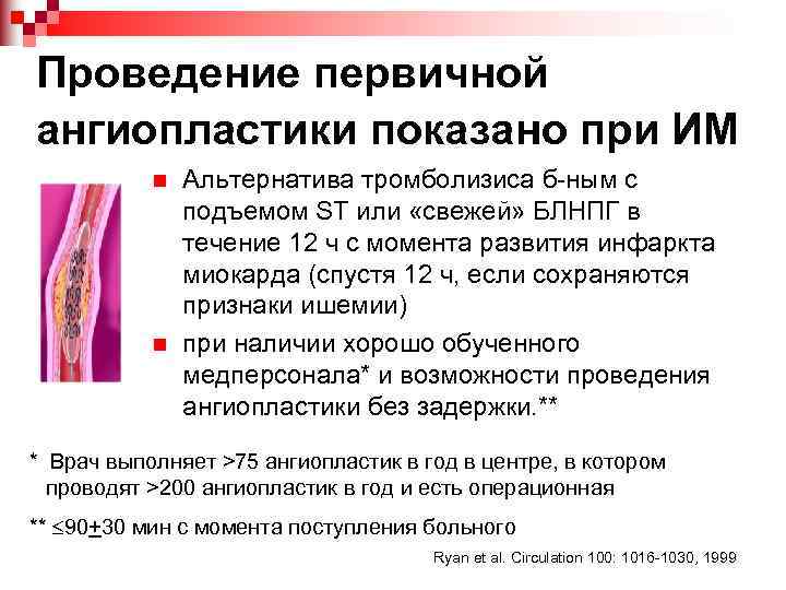 Проведение первичной ангиопластики показано при ИМ n n Альтернатива тромболизиса б-ным с подъемом ST