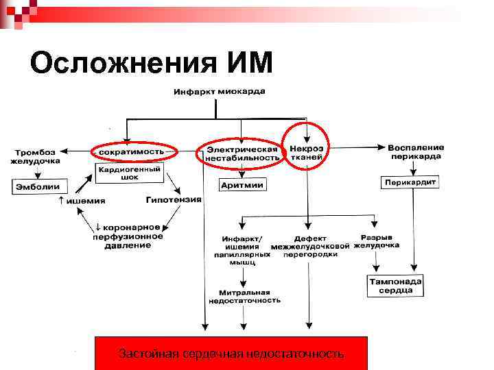 Осложнения ИМ Застойная сердечная недостаточность 