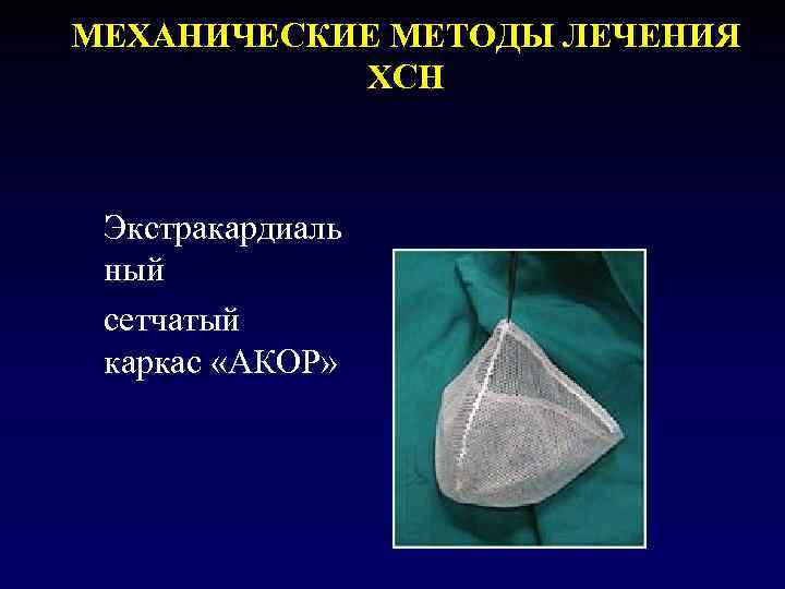 МЕХАНИЧЕСКИЕ МЕТОДЫ ЛЕЧЕНИЯ ХСН Экстракардиаль ный сетчатый каркас «АКОР» 