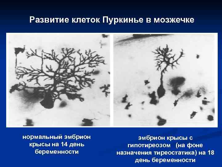 Развитие клеток Пуркинье в мозжечке нормальный эмбрион крысы на 14 день беременности эмбрион крысы
