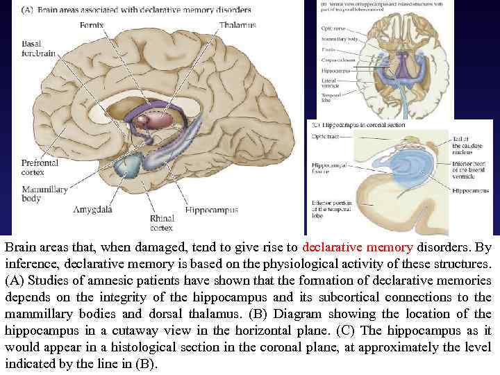 Brain areas that, when damaged, tend to give rise to declarative memory disorders. By