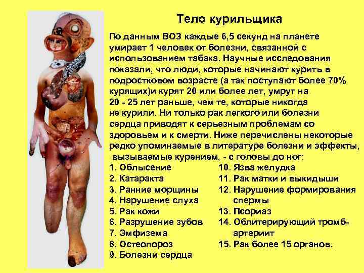 Тело курильщика По данным ВОЗ каждые 6, 5 секунд на планете умирает 1 человек