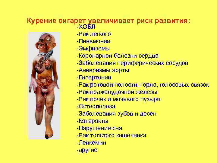 Курение сигарет увеличивает риск развития: -ХОБЛ -Рак легкого -Пневмонии -Эмфиземы -Коронарной болезни сердца -Заболевания