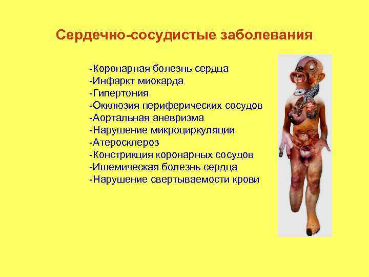 Сердечно-сосудистые заболевания -Коронарная болезнь сердца -Инфаркт миокарда -Гипертония -Окклюзия периферических сосудов -Аортальная аневризма -Нарушение