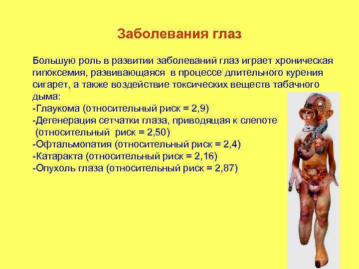 Заболевания глаз Большую роль в развитии заболеваний глаз играет хроническая гипоксемия, развивающаяся в процессе