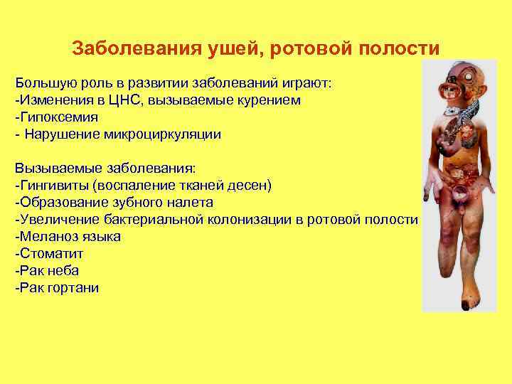 Заболевания ушей, ротовой полости Большую роль в развитии заболеваний играют: -Изменения в ЦНС, вызываемые