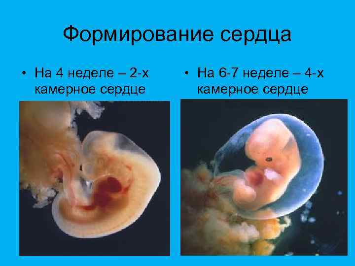 Формирование сердца • На 4 неделе – 2 -х камерное сердце • На 6