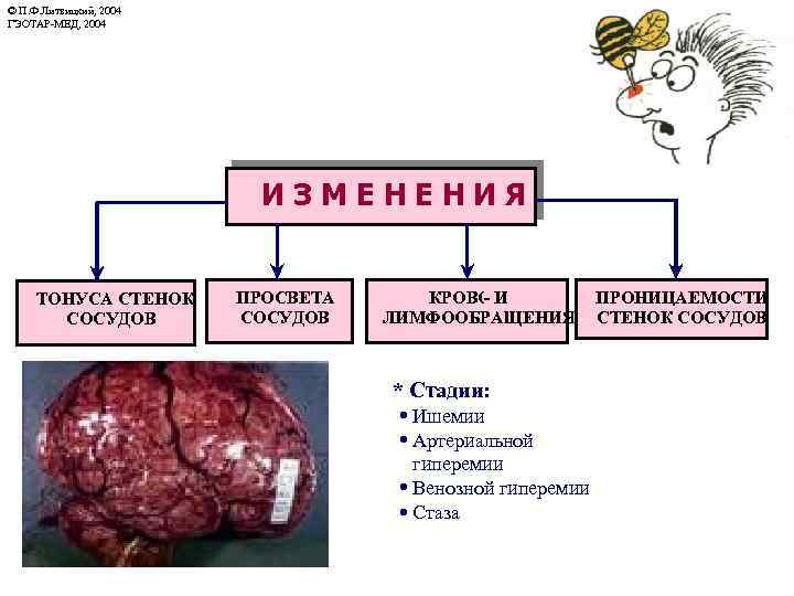 © П. Ф. Литвицкий, 2004 ГЭОТАР-МЕД, 2004 © ИЗМЕНЕНИЯ ТОНУСА СТЕНОК СОСУДОВ ПРОСВЕТА СОСУДОВ