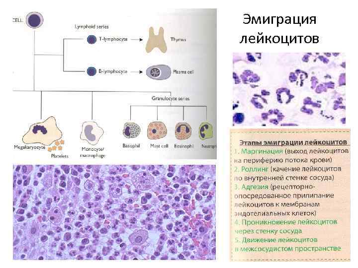 Эмиграция лейкоцитов 