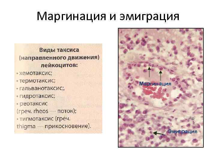 Маргинация и эмиграция Маргинация Эмиграция 