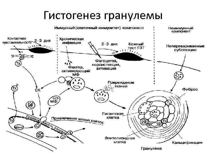 Гистогенез гранулемы 