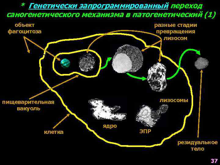 * Генетически запрограммированный переход саногенетического механизма в патогенетический (1) объект фагоцитоза разные стадии превращения