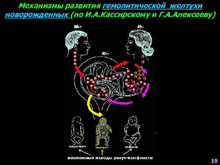 Механизмы развития гемолитической желтухи новорожденных (по И. А. Кассирскому и Г. А. Алексееву) 19