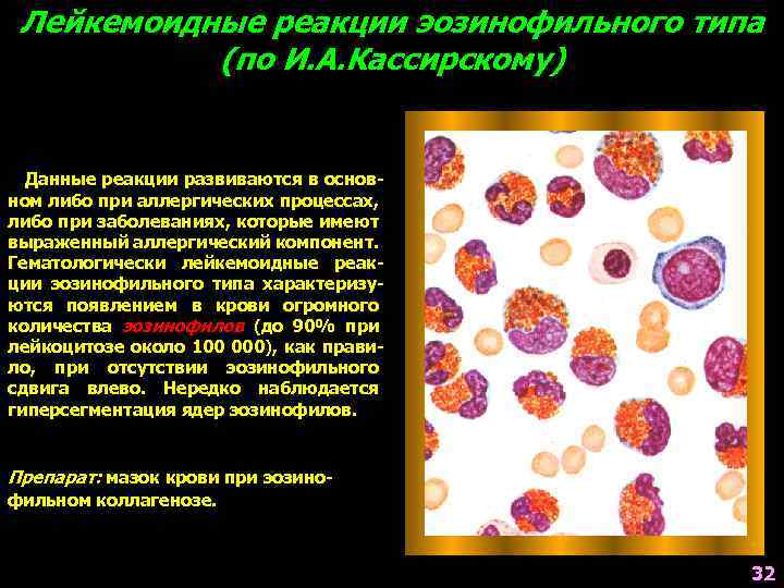 Лейкемоидные реакции эозинофильного типа (по И. А. Кассирскому) Данные реакции развиваются в основном либо